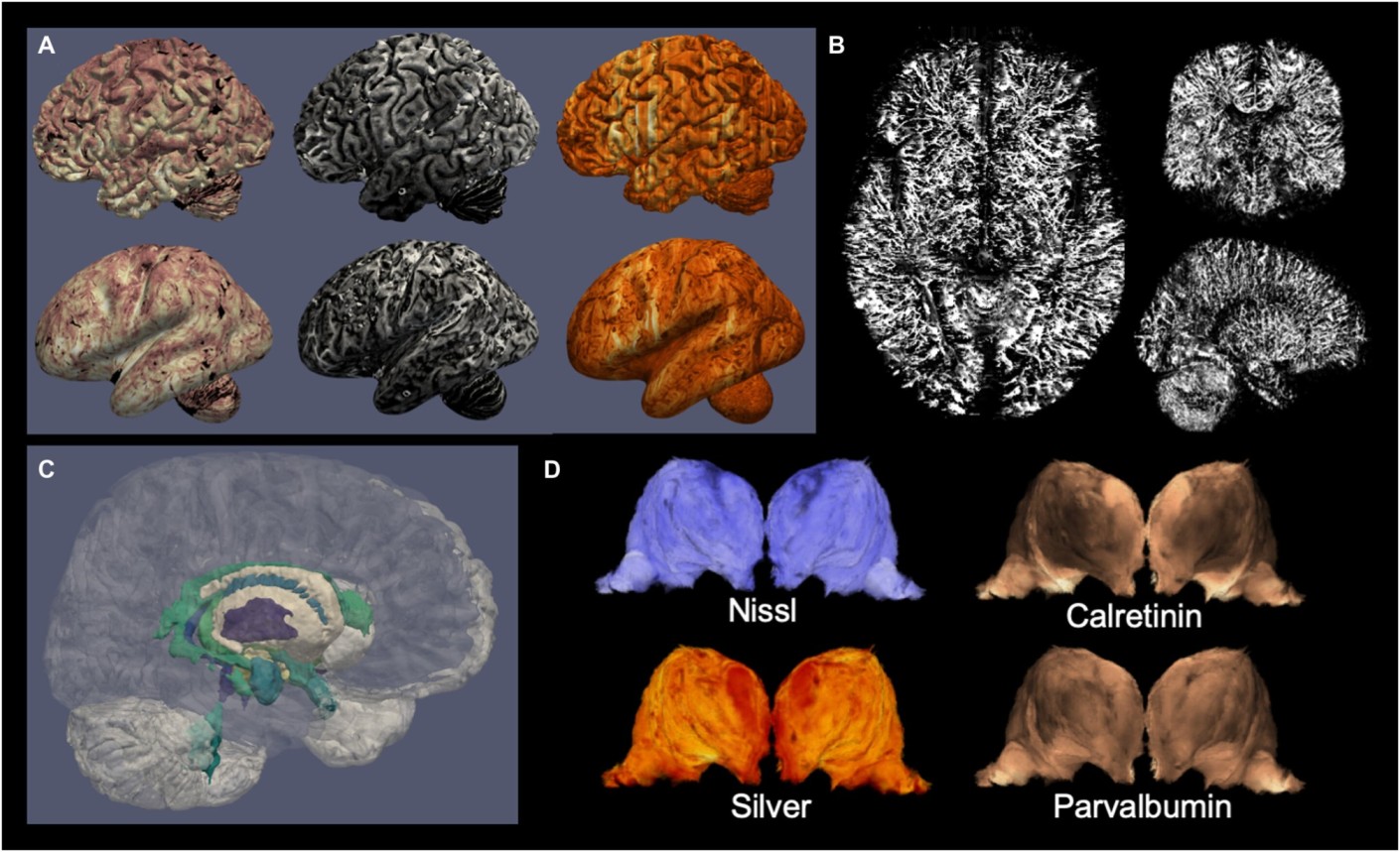 Human Brain 3D map