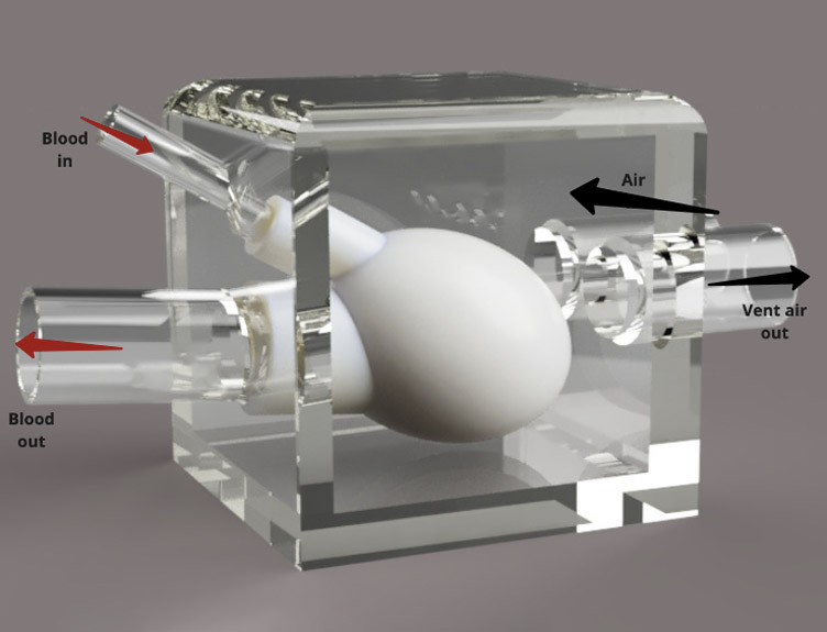 Render of the silicone heart chamber inside a rigid plastic container which was used to redirect the pressurised air to compress the heart chamber to simulate contractions of the heart.